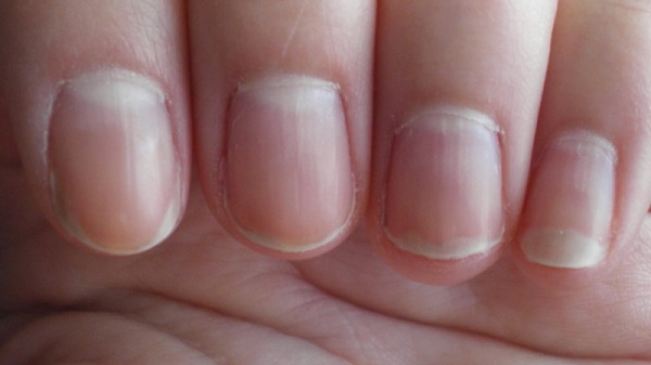 6-things-your-fingernails-can-say-about-your-health